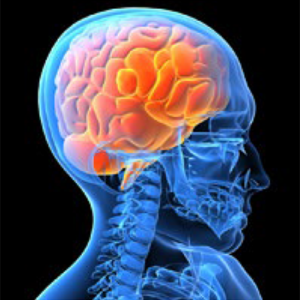 Post-Concussion Syndrome
